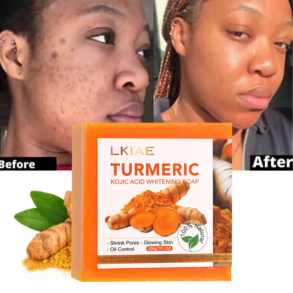 AILKE Brightening & Acne Control Skin Care Set – Glutathione, Vitamin C & Aloe Vera