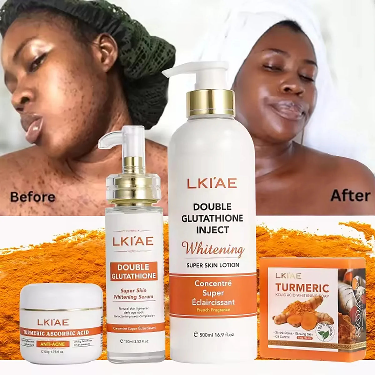 AILKE Brightening & Acne Control Skin Care Set – Glutathione, Vitamin C & Aloe Vera